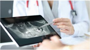 digital xrays